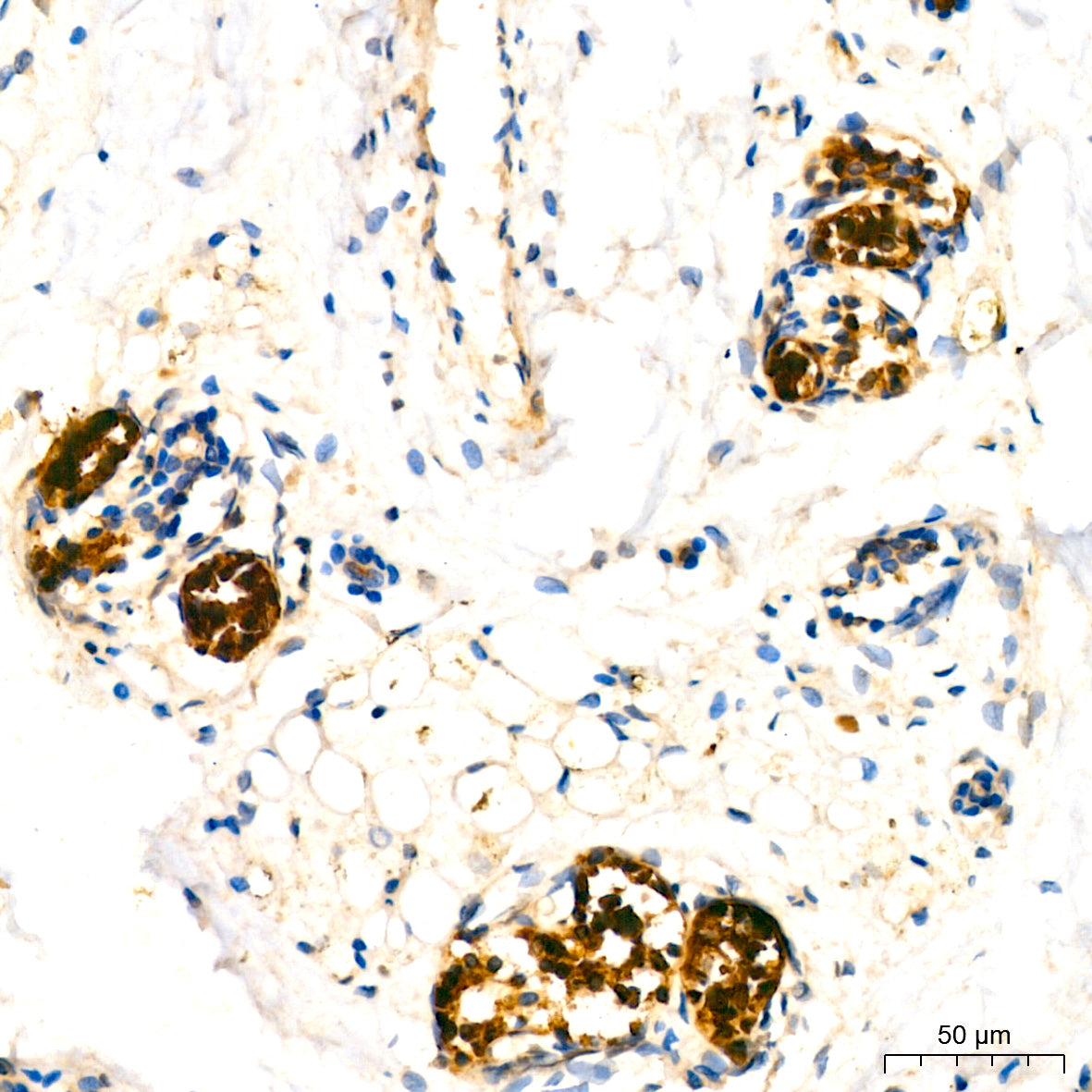 Mammaglobin A Rabbit mAb