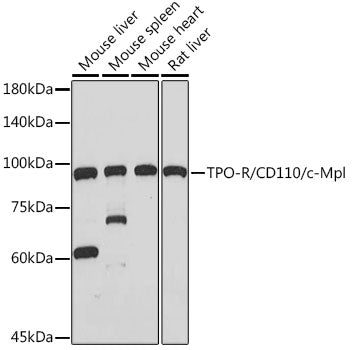 TPO-R/CD110/c-Mpl Rabbit mAb