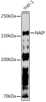 NAIP Rabbit mAb