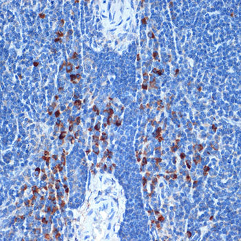 NAIP Rabbit mAb