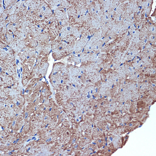 CDC42EP1 Rabbit mAb