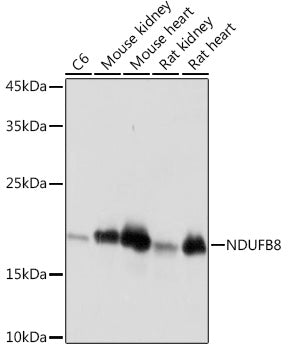 NDUFB8 Rabbit mAb
