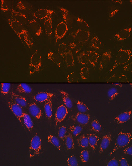 NDUFB8 Rabbit mAb