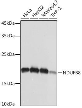 NDUFB8 Rabbit mAb