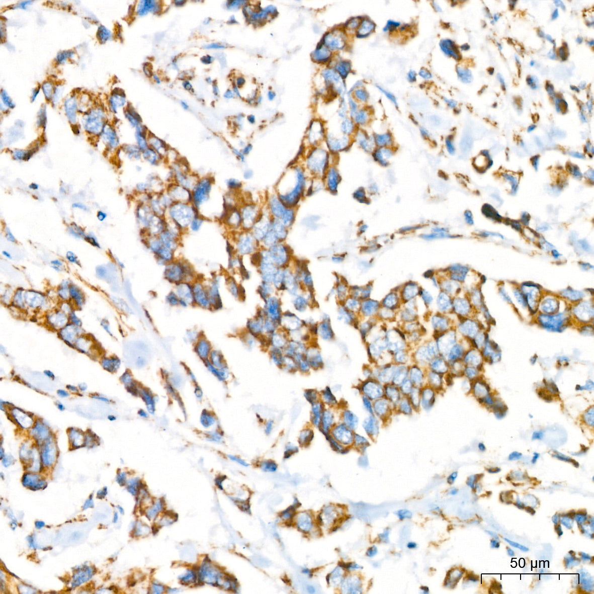 NDUFB8 Rabbit mAb
