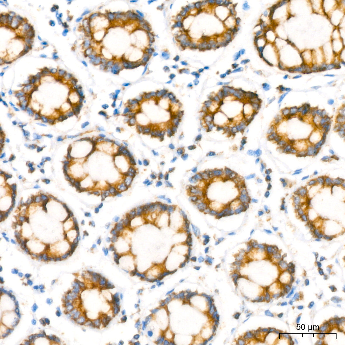 NDUFB8 Rabbit mAb