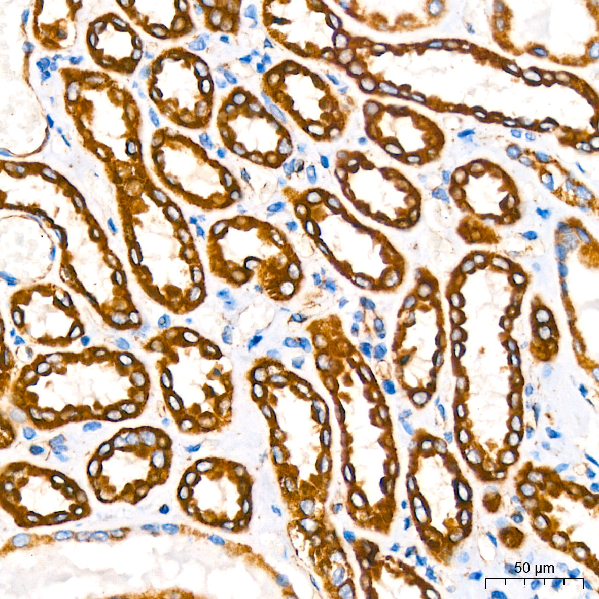 NDUFB8 Rabbit mAb