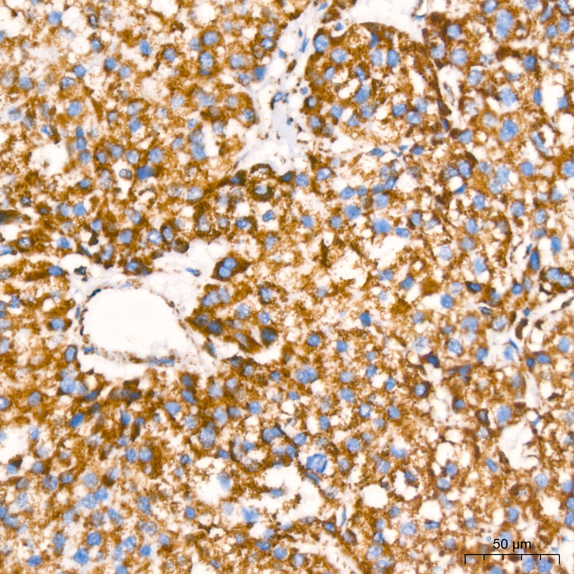 NDUFB8 Rabbit mAb
