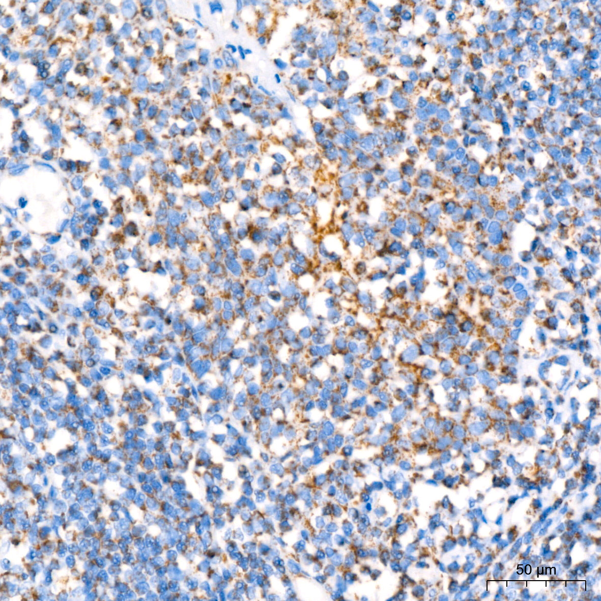 NDUFB8 Rabbit mAb