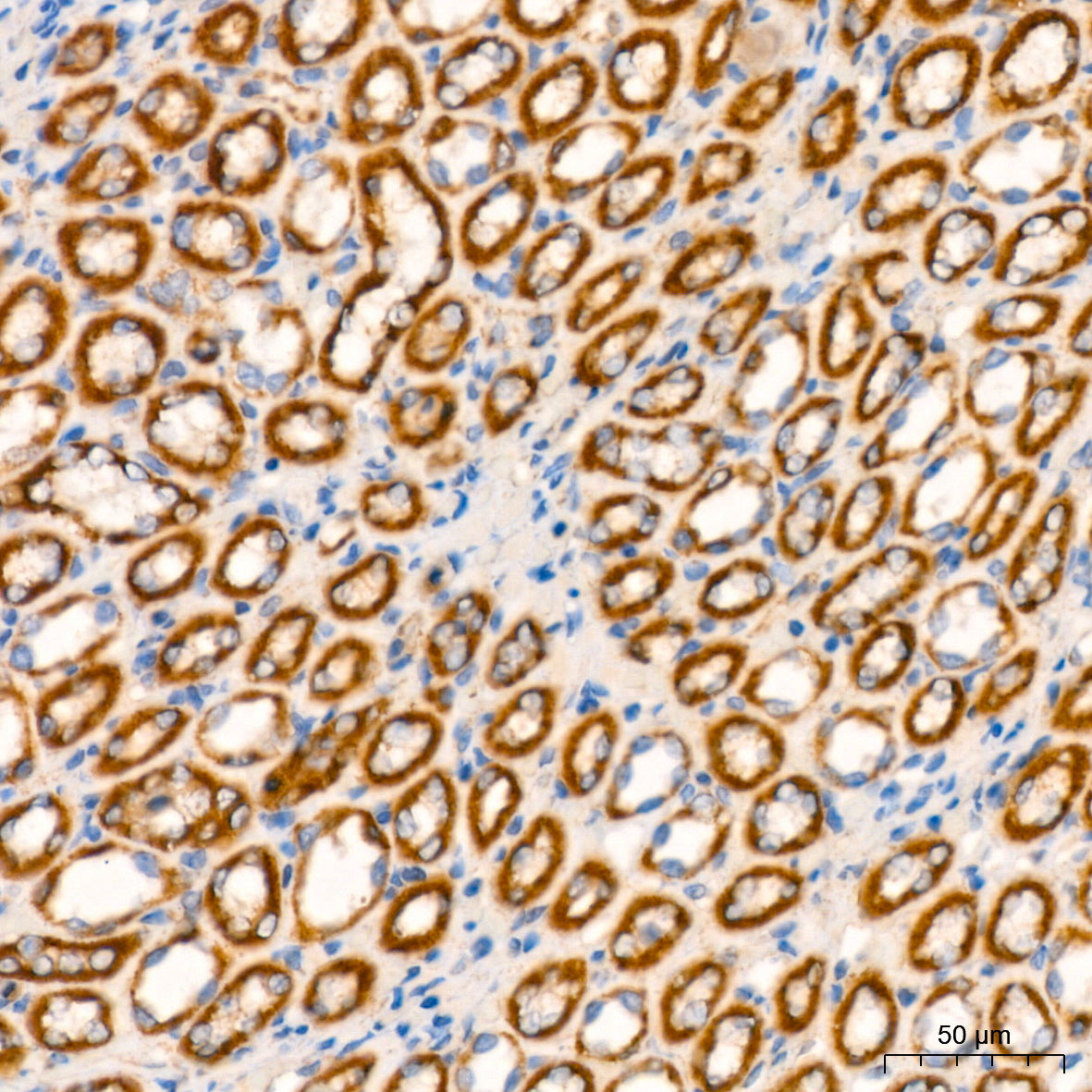 NDUFB8 Rabbit mAb