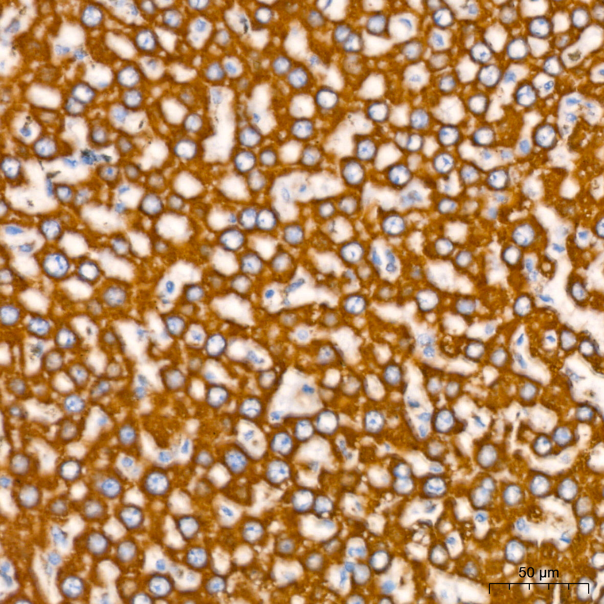 NDUFB8 Rabbit mAb