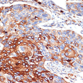 ORM1/2 Rabbit mAb