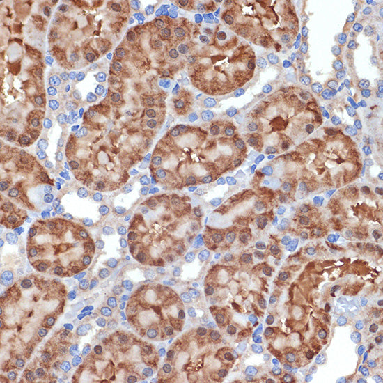 MEKK2 Rabbit mAb