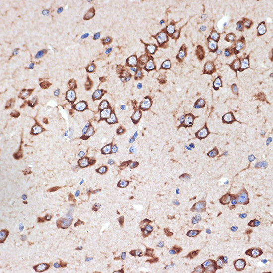MEKK2 Rabbit mAb