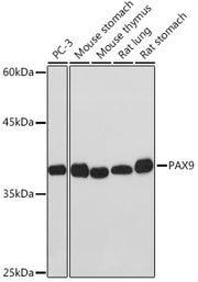 PAX9 Rabbit mAb