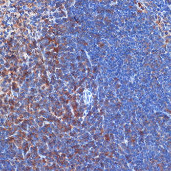 PI3 Kinase p110 delta Rabbit mAb