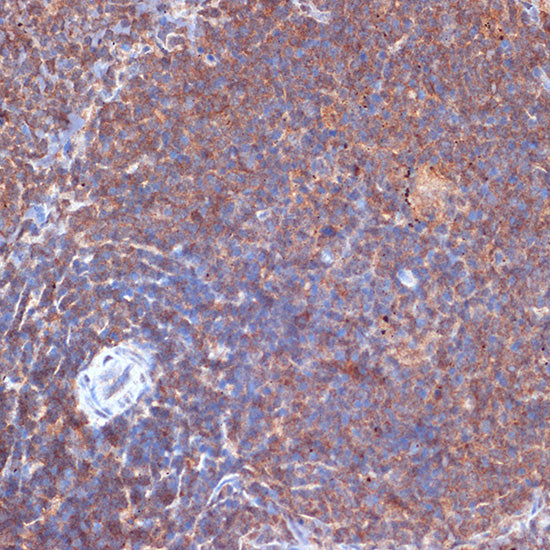 PI3 Kinase p110 delta Rabbit mAb