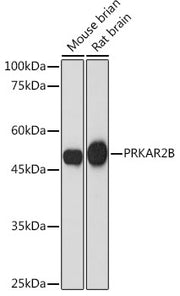 PRKAR2B Rabbit mAb