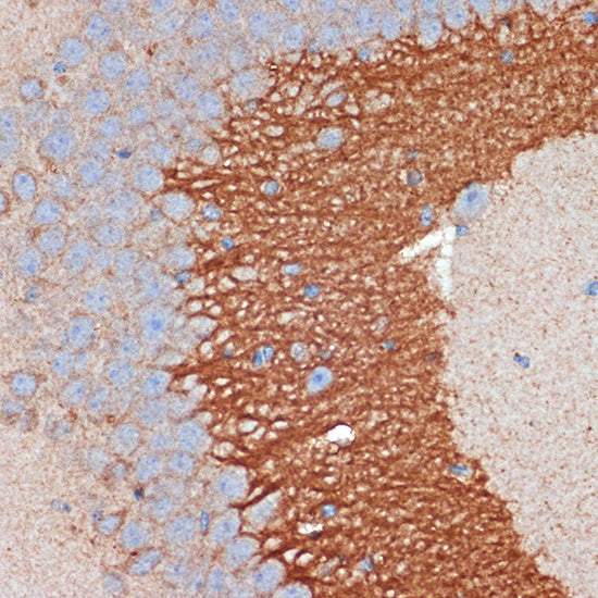 PRKAR2B Rabbit mAb