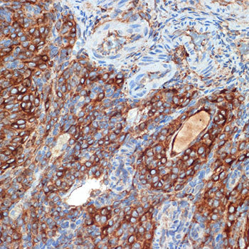 PRKAR2B Rabbit mAb