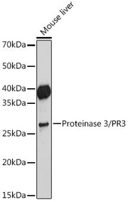Proteinase 3/PR3 Rabbit mAb