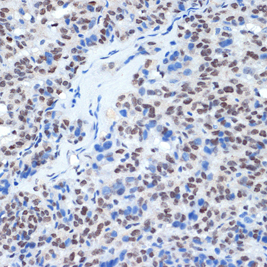 RING1A Rabbit mAb