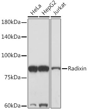 Radixin Rabbit mAb