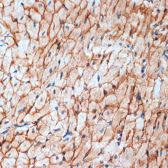 alpha Sarcoglycan (SGCA) Rabbit mAb