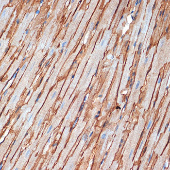 alpha Sarcoglycan (SGCA) Rabbit mAb