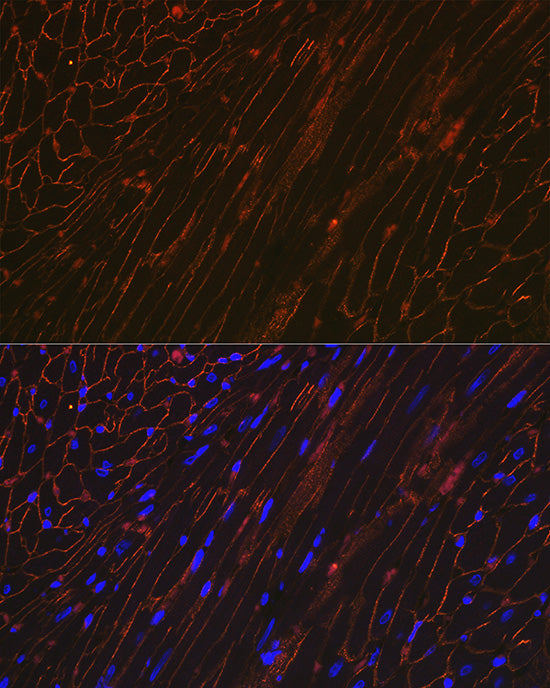 alpha Sarcoglycan (SGCA) Rabbit mAb