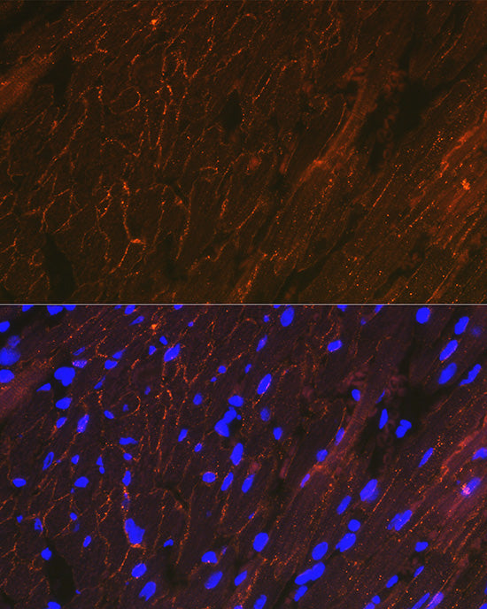 alpha Sarcoglycan (SGCA) Rabbit mAb