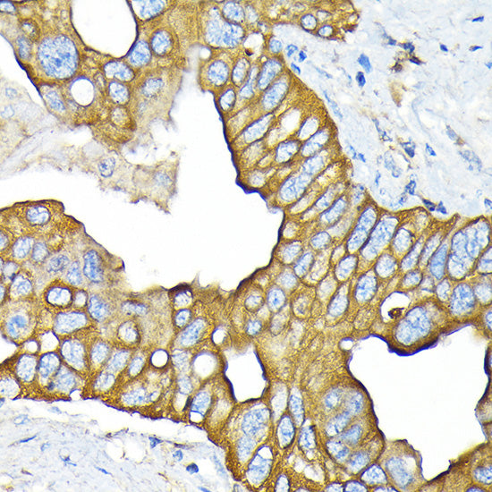 SLC22A3/OCT3 Rabbit mAb