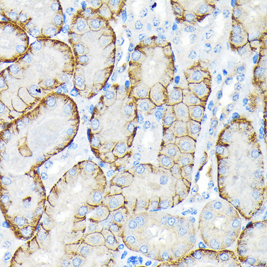 SLC22A3/OCT3 Rabbit mAb