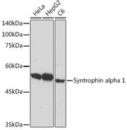 Syntrophin alpha 1 Rabbit mAb