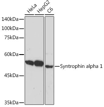 Syntrophin alpha 1 Rabbit mAb