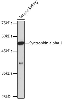 Syntrophin alpha 1 Rabbit mAb
