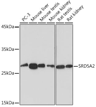 SRD5A2 Rabbit mAb