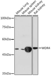 WDR4 Rabbit mAb