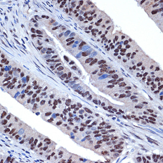 WDR4 Rabbit mAb