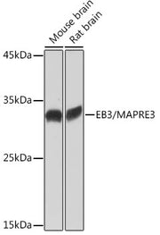EB3/MAPRE3 Rabbit mAb