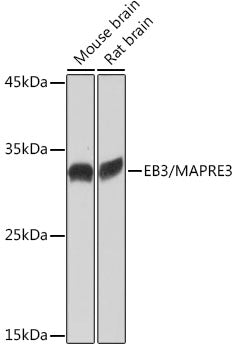 EB3/MAPRE3 Rabbit mAb