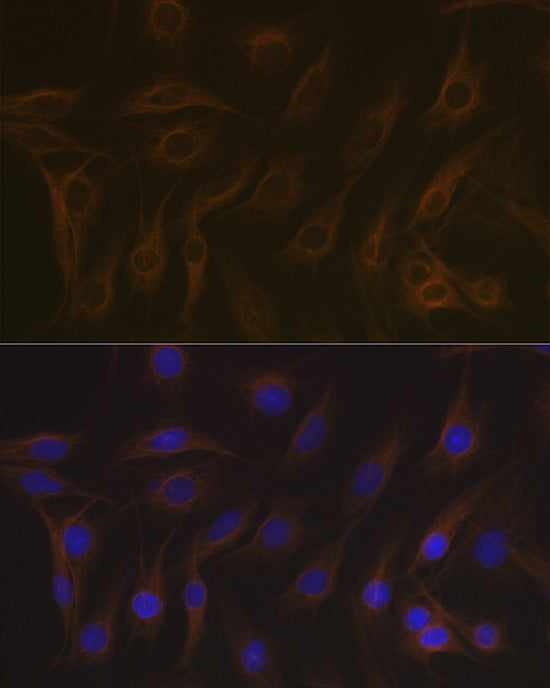 EB3/MAPRE3 Rabbit mAb