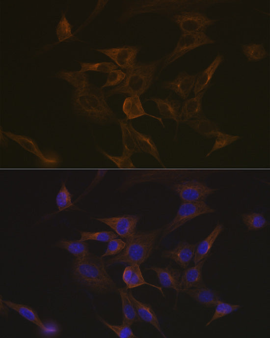 EB3/MAPRE3 Rabbit mAb
