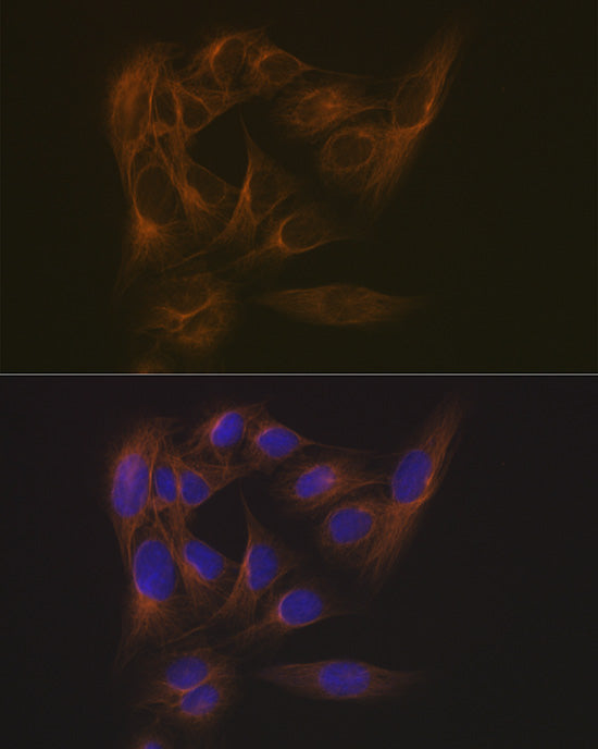 EB3/MAPRE3 Rabbit mAb