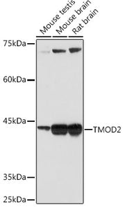 TMOD2 Rabbit mAb