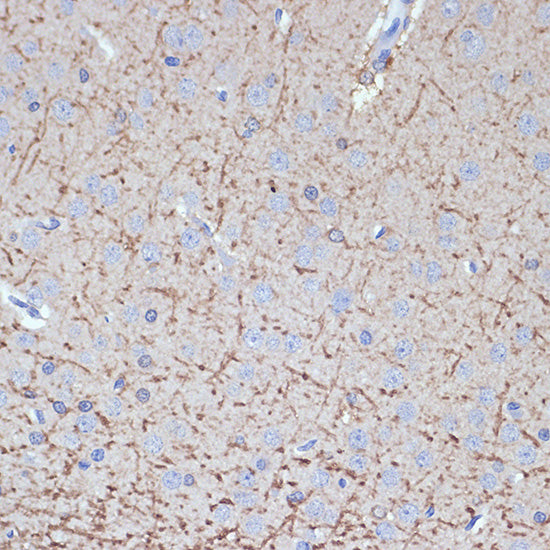 TMOD2 Rabbit mAb