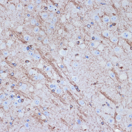 TMOD2 Rabbit mAb