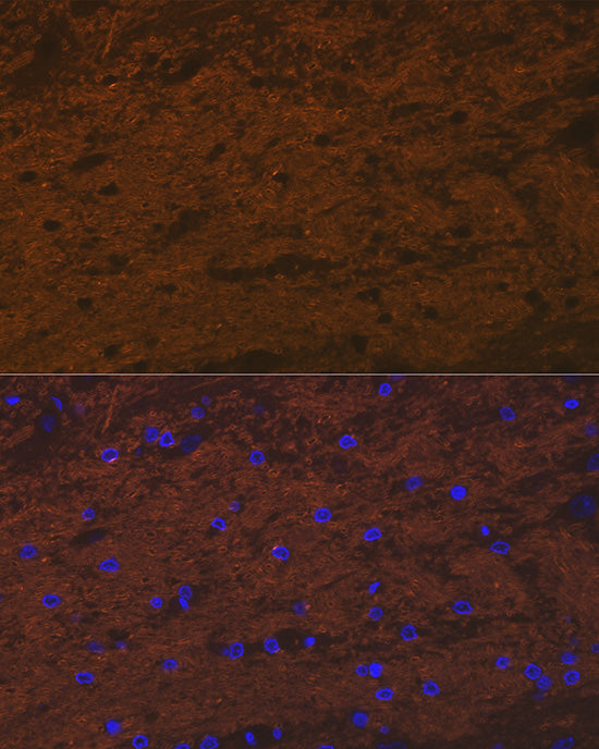 TMOD2 Rabbit mAb