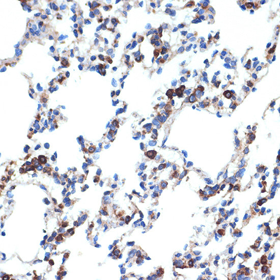 ERp29 Rabbit mAb