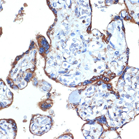 ERp29 Rabbit mAb